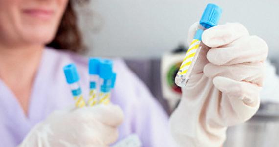 Laboratório de Patologia Clínica do HGF bate mais um recorde