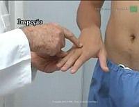 Vídeo-aula feita pelo Serviço de Reumatologia do HGF é disponibilizado na internet pela Sociedade Brasileira de Reumatologia