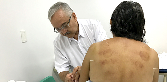 Acupuntura auxilia no alívio da dor crônica