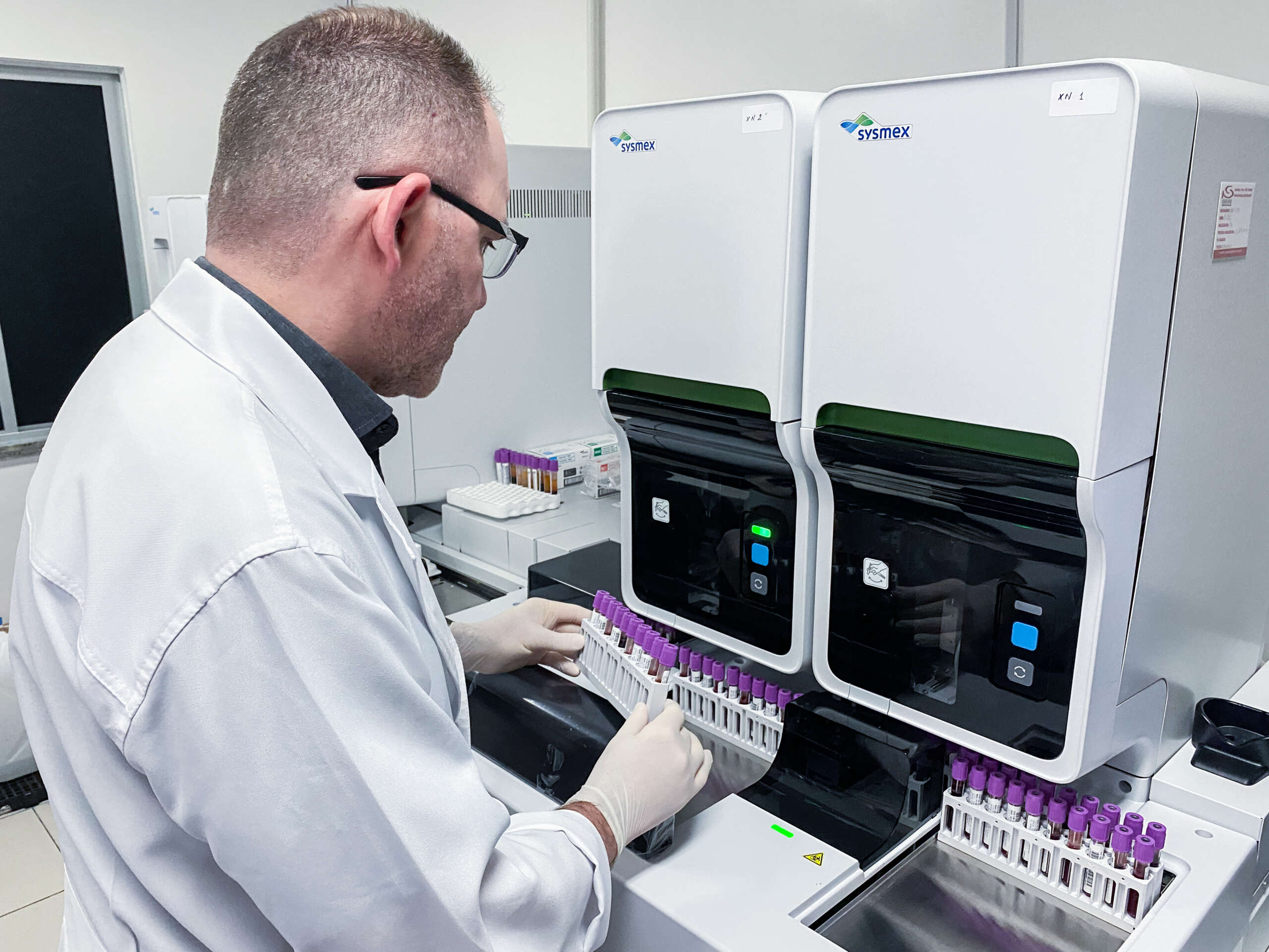 HGF adota nova tecnologia para análises de hemogramas