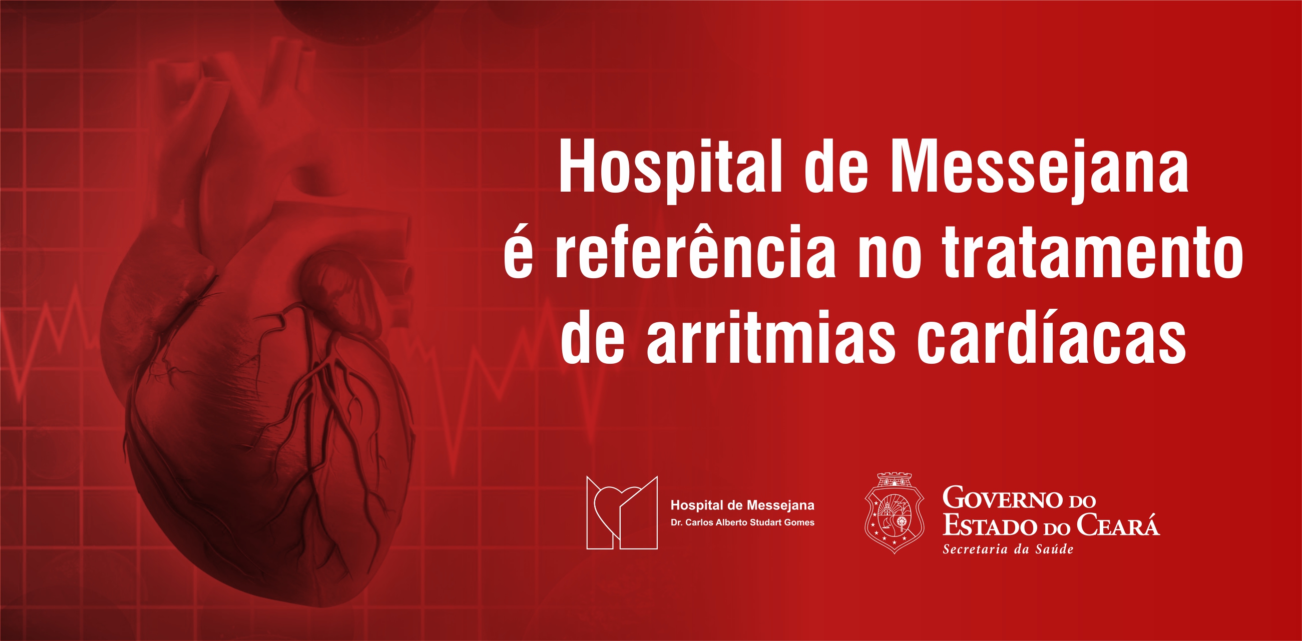 Arritmia cardíaca: conheça mais sobre a doença e saiba como tratá-la