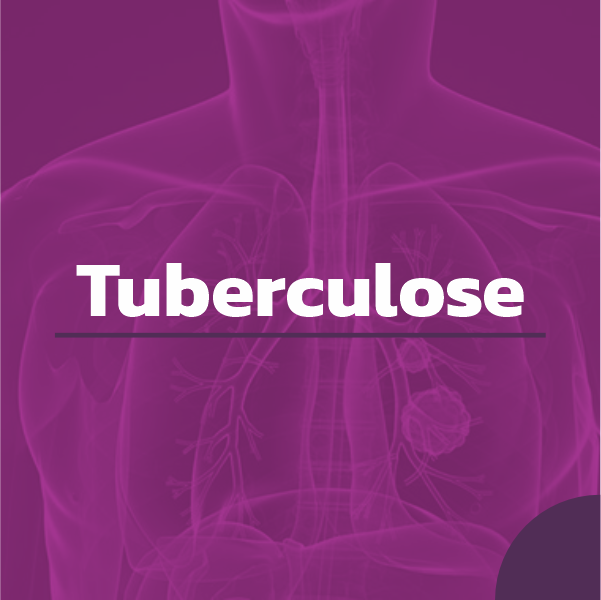 Tuberculose
