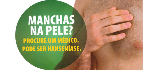 Curso qualifica atenção básica no diagnóstico da hanseníase
