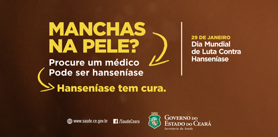 Saúde mobiliza população no combate à hanseníase
