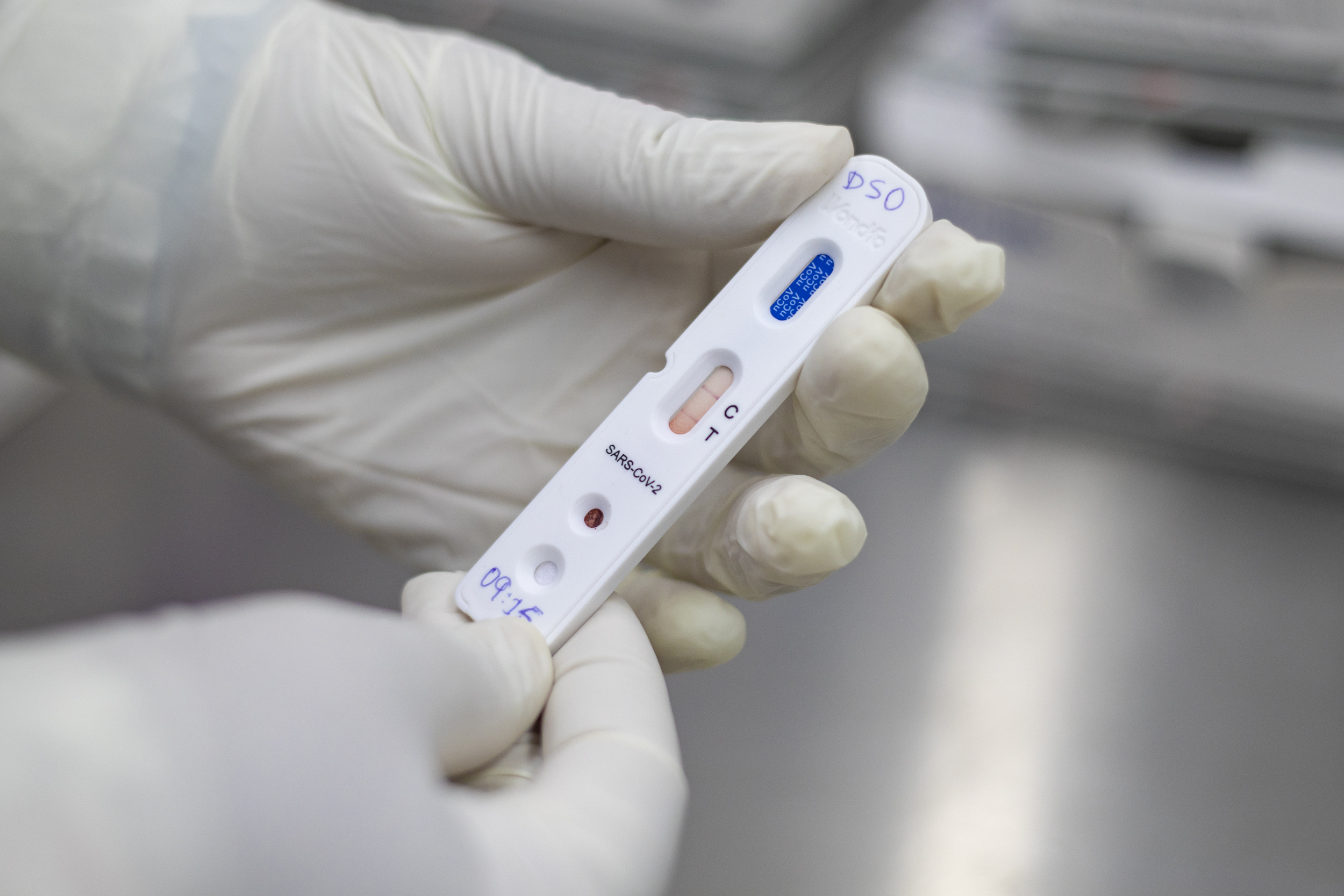 Ceará investe na ampliação de testes para diagnóstico da doença