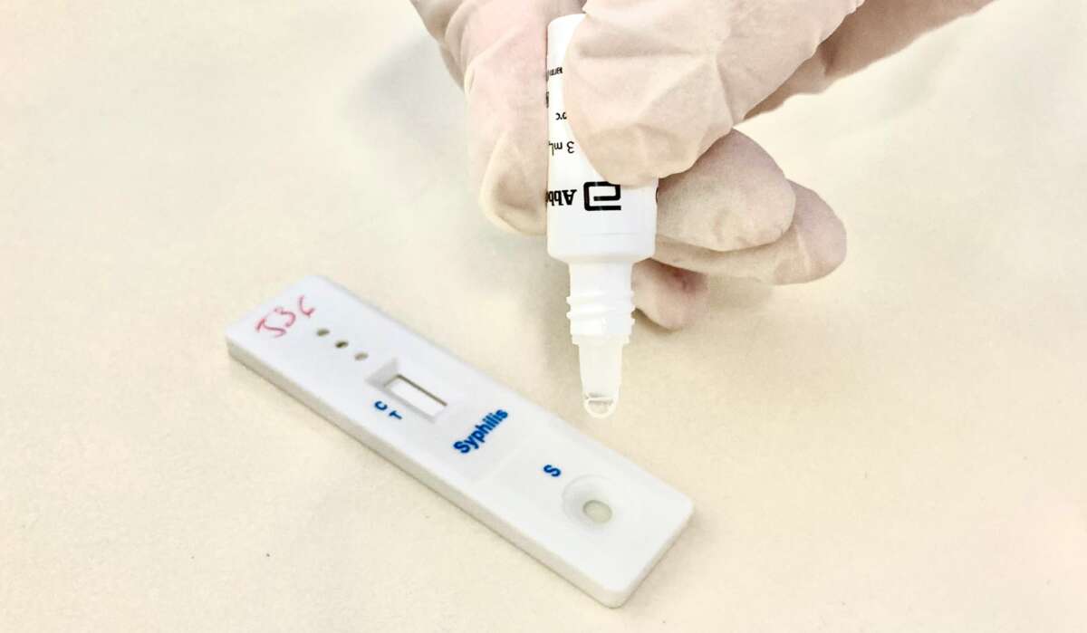 Ceará tem três cidades certificadas com o Selo Prata de Boas Práticas Rumo à Eliminação da Transmissão Vertical da hepatite B e da sífilis