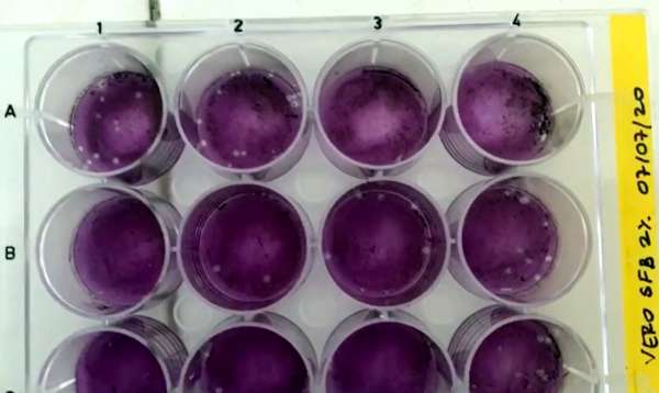 Uece avança no desenvolvimento de vacina contra Covid-19