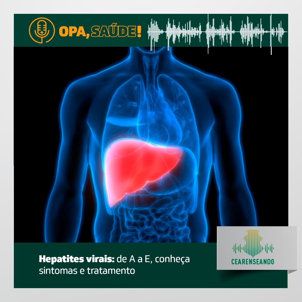 Opa, Saúde! #15 – Hepatites virais: de A a E, conheça sintomas e tratamento