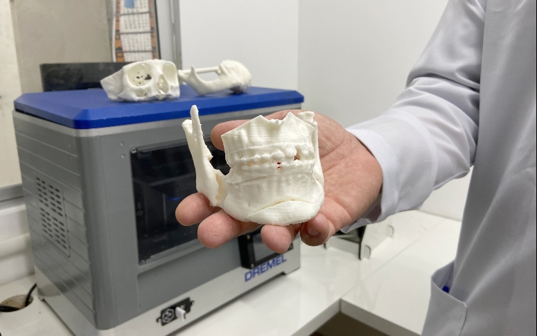 No HGF, impressora 3D garante mais celeridade e assertividade em procedimentos cirúrgicos da Odontologia