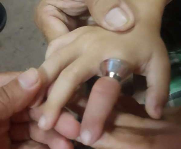 Bombeiros alertam responsáveis sobre uso de anéis e alianças em crianças