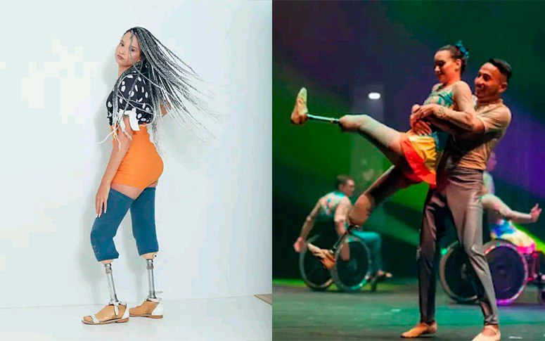 Da dor à superação: jovem tem vida ressignificada após receber próteses de pernas