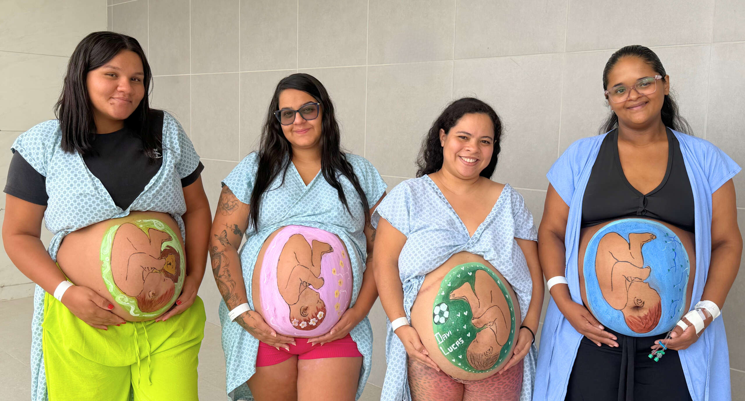 Pintura gestacional fortalece vínculo materno e saúde emocional no Hospital Universitário do Ceará