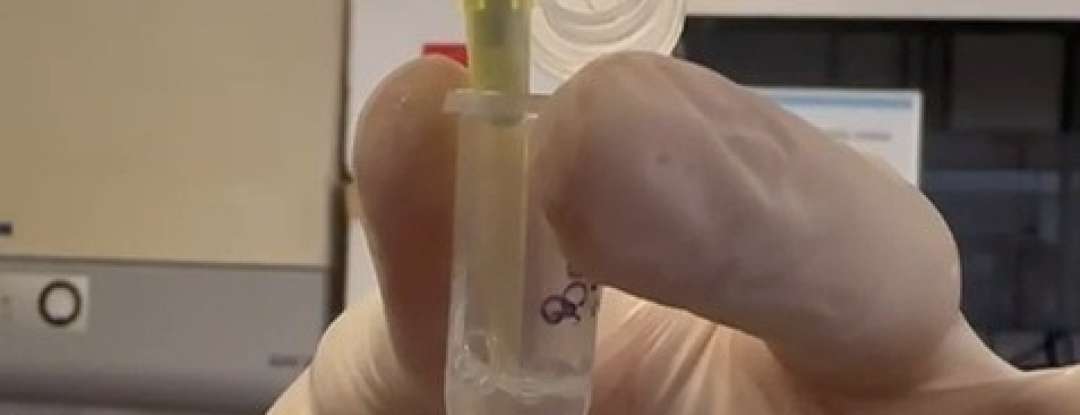 Tratamento inédito será aplicado pela Uece em crianças com Síndrome de Rett