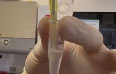 Tratamento inédito será aplicado pela Uece em crianças com Síndrome de Rett