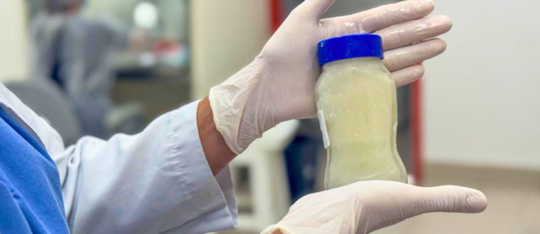 HGF reforça importância da doação de frascos de vidro para armazenamento de leite humano