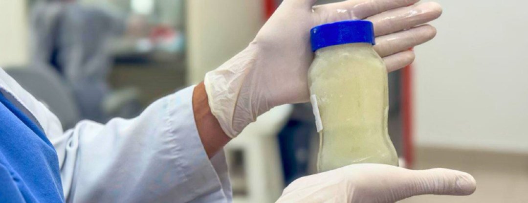HGF reforça importância da doação de frascos de vidro para armazenamento de leite humano